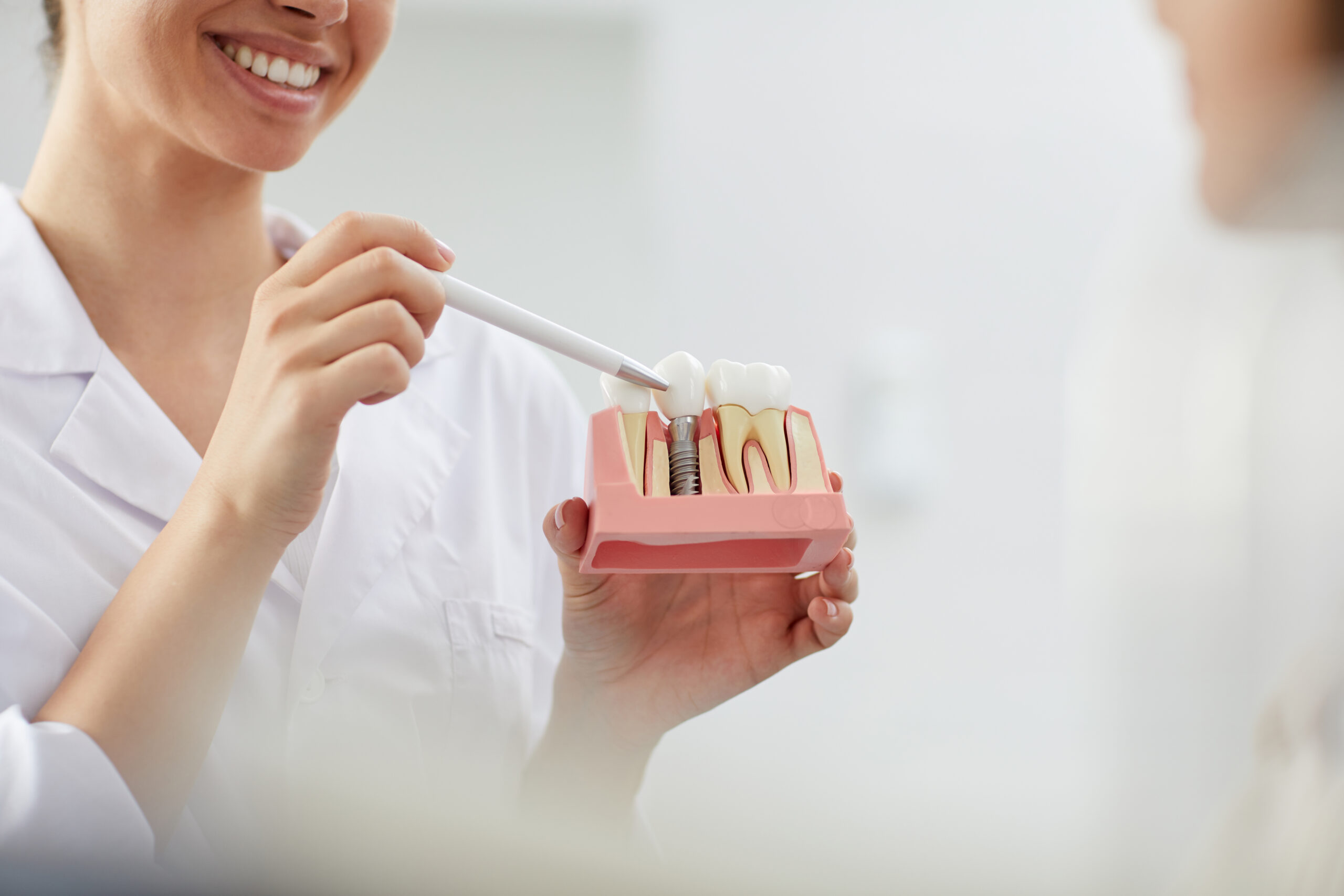 Dental Implant – Parkway Clinic Dental Implant - Parkway Clinic